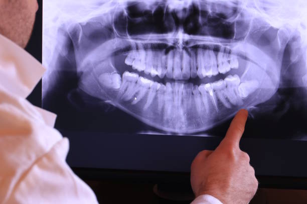 Best Emergency Dental Care for Trauma or Injury in Diamondhead, MS