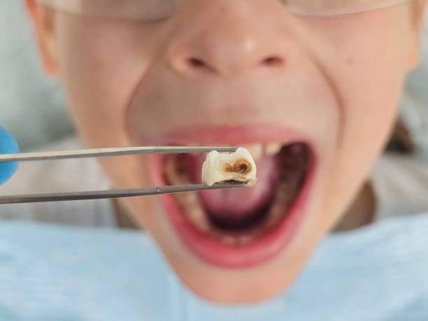 Best Emergency Treatment for Toothache in Diamondhead, MS